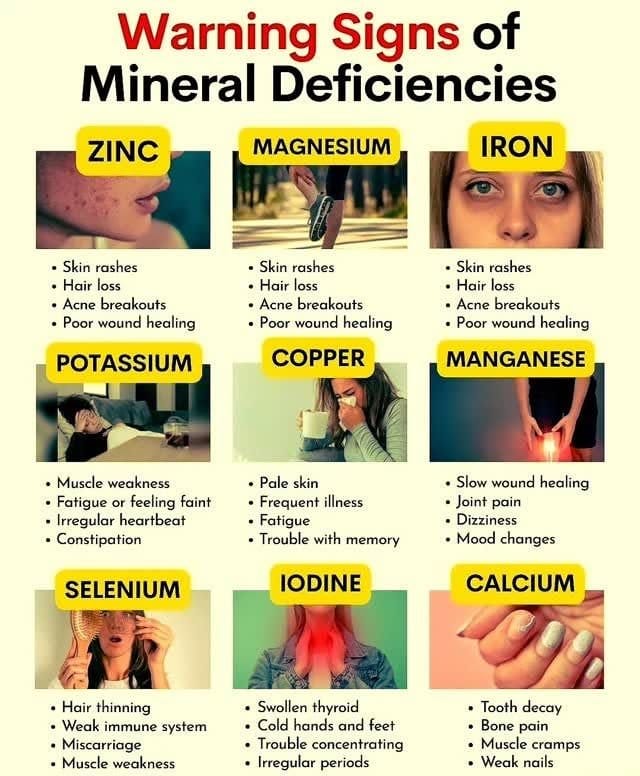Warning Signs of Vital Mineral Deficiencies 2 Warning-Signs-Of-Vital-Minerals-Deficiencies