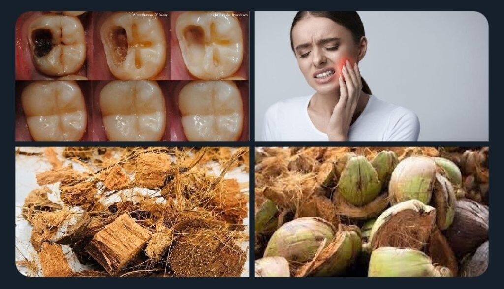 Toothache-Relief-Simple-Home-Remedies-That-Actually-Help